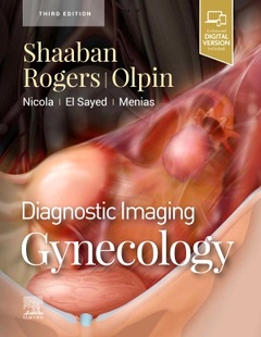 Couverture de l’ouvrage Diagnostic Imaging: Gynecology