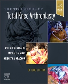 Couverture de l’ouvrage The Technique of Total Knee Arthroplasty