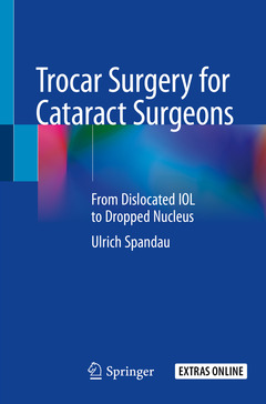 Couverture de l’ouvrage Trocar Surgery for Cataract Surgeons