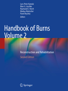 Couverture de l’ouvrage Handbook of Burns Volume 2