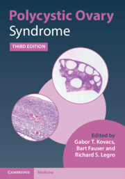 Couverture de l’ouvrage Polycystic Ovary Syndrome