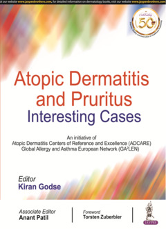Couverture de l’ouvrage Atopic Dermatitis and Pruritus