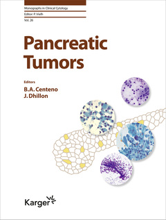Couverture de l’ouvrage Pancreatic Tumors