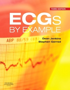 Couverture de l’ouvrage ECGs by Example