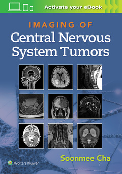 Couverture de l’ouvrage Imaging of Central Nervous System Tumors