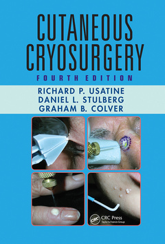 Couverture de l’ouvrage Cutaneous Cryosurgery