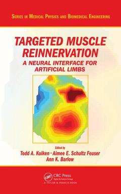 Couverture de l’ouvrage Targeted Muscle Reinnervation