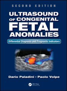 Couverture de l’ouvrage Ultrasound of Congenital Fetal Anomalies