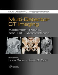 Couverture de l’ouvrage Multi-Detector CT Imaging