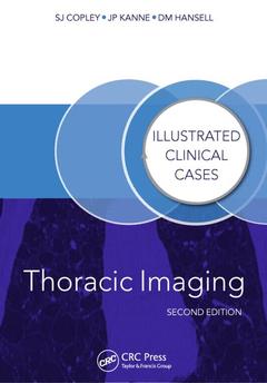 Cover of the book Thoracic Imaging