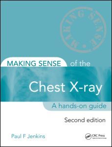 Cover of the book Making Sense of the Chest X-ray