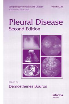 Cover of the book Pleural Disease