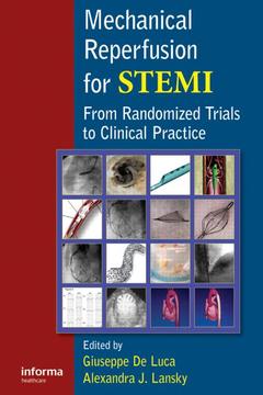 Couverture de l’ouvrage Mechanical Reperfusion for STEMI