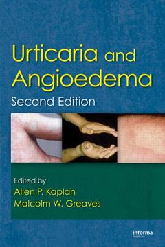 Couverture de l’ouvrage Urticaria and Angioedema