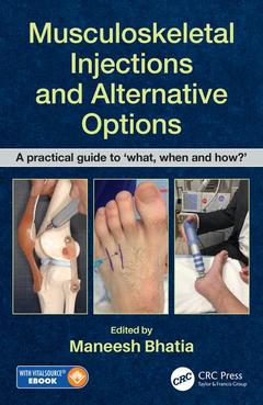 Couverture de l’ouvrage Musculoskeletal Injections and Alternative Options
