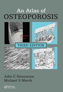 Couverture de l’ouvrage An Atlas of Osteoporosis