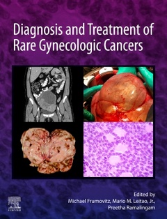 Couverture de l’ouvrage Diagnosis and Treatment of Rare Gynecologic Cancers