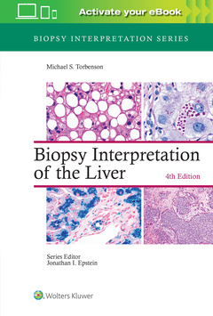 Couverture de l’ouvrage Biopsy Interpretation of the Liver