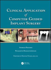 Couverture de l’ouvrage Clinical Application of Computer-Guided Implant Surgery