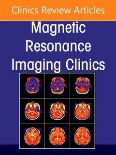Couverture de l’ouvrage MR Imaging of Head and Neck Cancer, An Issue of Magnetic Resonance Imaging Clinics of North America