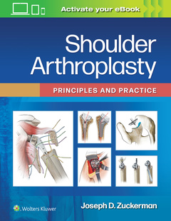 Cover of the book Shoulder Arthroplasty