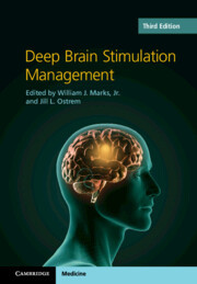 Cover of the book Deep Brain Stimulation Management
