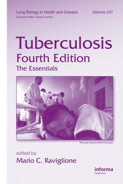 Cover of the book Tuberculosis