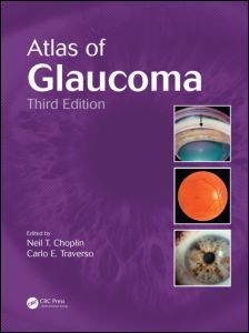 Couverture de l’ouvrage Atlas of Glaucoma