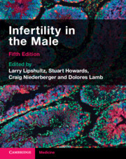 Couverture de l’ouvrage Infertility in the Male