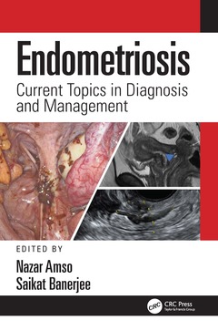 Couverture de l’ouvrage Endometriosis