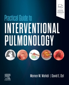 Couverture de l’ouvrage Practical Guide to Interventional Pulmonology