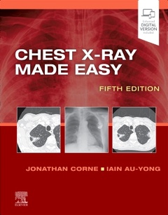 Couverture de l’ouvrage Chest X-Ray Made Easy