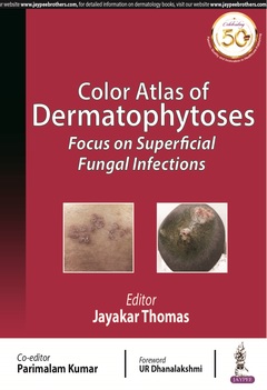 Couverture de l’ouvrage Color Atlas of Dermatophytoses