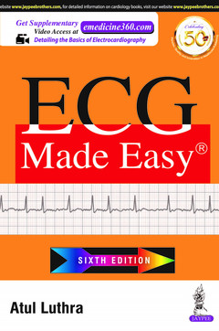 Couverture de l’ouvrage ECG Made Easy