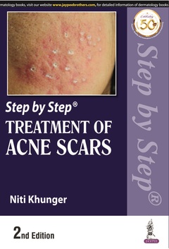 Couverture de l’ouvrage Step by Step Treatment of Acne Scars