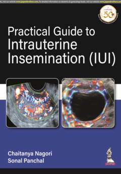 Couverture de l’ouvrage Practical Guide to Intrauterine Insemination (IUI)