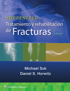 Couverture de l’ouvrage Hoppenfeld. Tratamiento y rehabilitación de fracturas