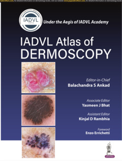 Couverture de l’ouvrage Atlas of Dermoscopy