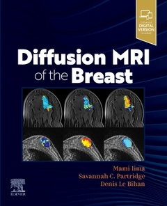 Couverture de l’ouvrage Diffusion MRI of the Breast