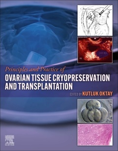 Couverture de l’ouvrage Principles and Practice of Ovarian Tissue Cryopreservation and Transplantation