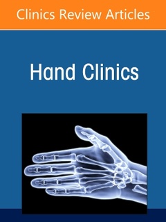 Couverture de l’ouvrage Current Concepts in Thumb Carpometacarpal Joint Disorders, An Issue of Hand Clinics