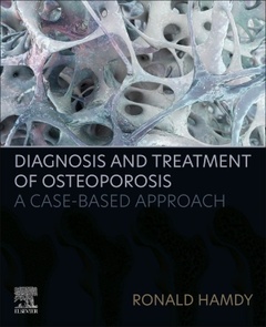 Couverture de l’ouvrage Diagnosis and Treatment of Osteoporosis