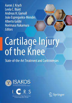 Couverture de l’ouvrage Cartilage Injury of the Knee