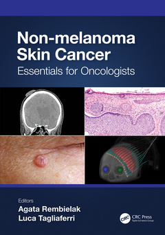 Couverture de l’ouvrage Non-melanoma Skin Cancer
