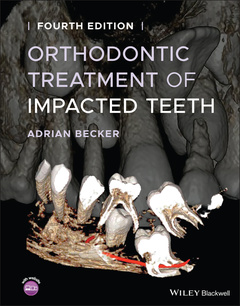 Couverture de l’ouvrage Orthodontic Treatment of Impacted Teeth