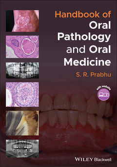 Couverture de l’ouvrage Handbook of Oral Pathology and Oral Medicine