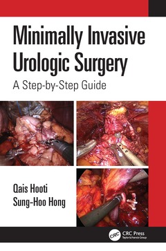 Couverture de l’ouvrage Minimally Invasive Urologic Surgery