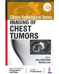 Couverture de l’ouvrage Clinico Radiological Series: Imaging of Chest Tumors