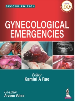 Couverture de l’ouvrage Gynecological Emergencies