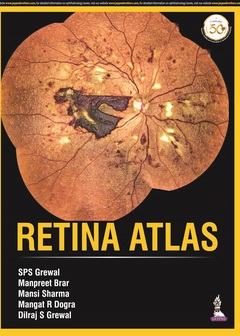 Cover of the book Retina Atlas